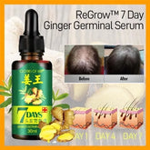 ReGrow 7 Day Ginger Germinal Serum bottle with before and after hair growth images on an orange background.