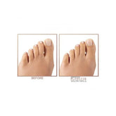 Before and after comparison of toes with 'Flawless Salon Nails' text.