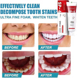 Before and after comparison of teeth with a toothpaste tube