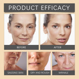 OUHOE Botox Bee Venom Wrinkle Cream