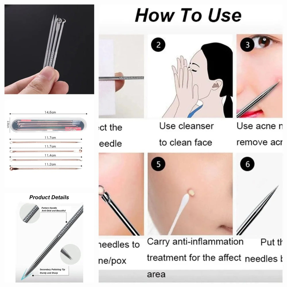 Instructional collage titled 'How To Use' showing a set of anti-inflammatory acne needles, including product details, needle sizes, step-by-step usage instructions with illustrated and real close-up photos, and care/cleansing guidance.