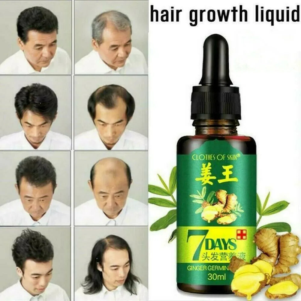 Bottle of hair growth liquid with before and after images of a man's hair.