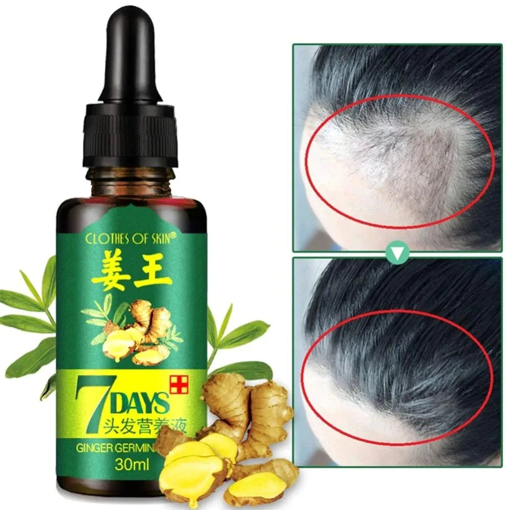 Bottle of 7 Days hair growth serum with ginger ingredients and before-and-after hair growth images.