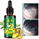 Bottle of 7 Days hair growth serum with ginger ingredients and before-and-after hair growth images.
