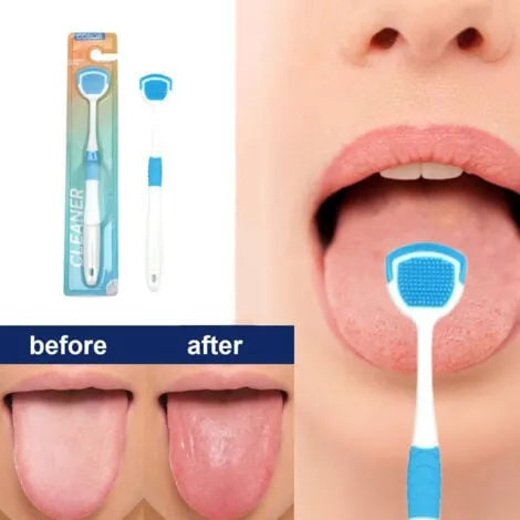 Silicone bristle tongue cleaner and scraper for effective daily tongue cleaning and fresh breath.
