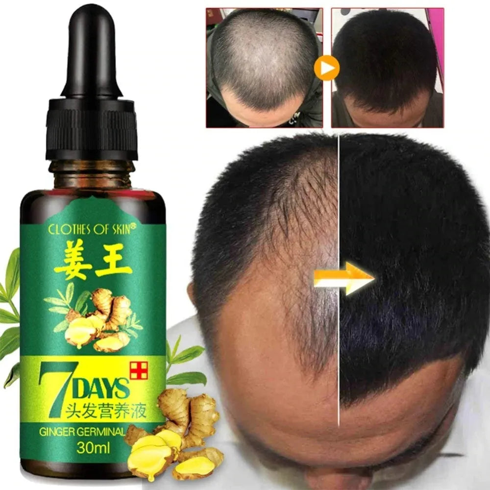 Bottle of hair growth serum with before and after hair growth comparison on a white background