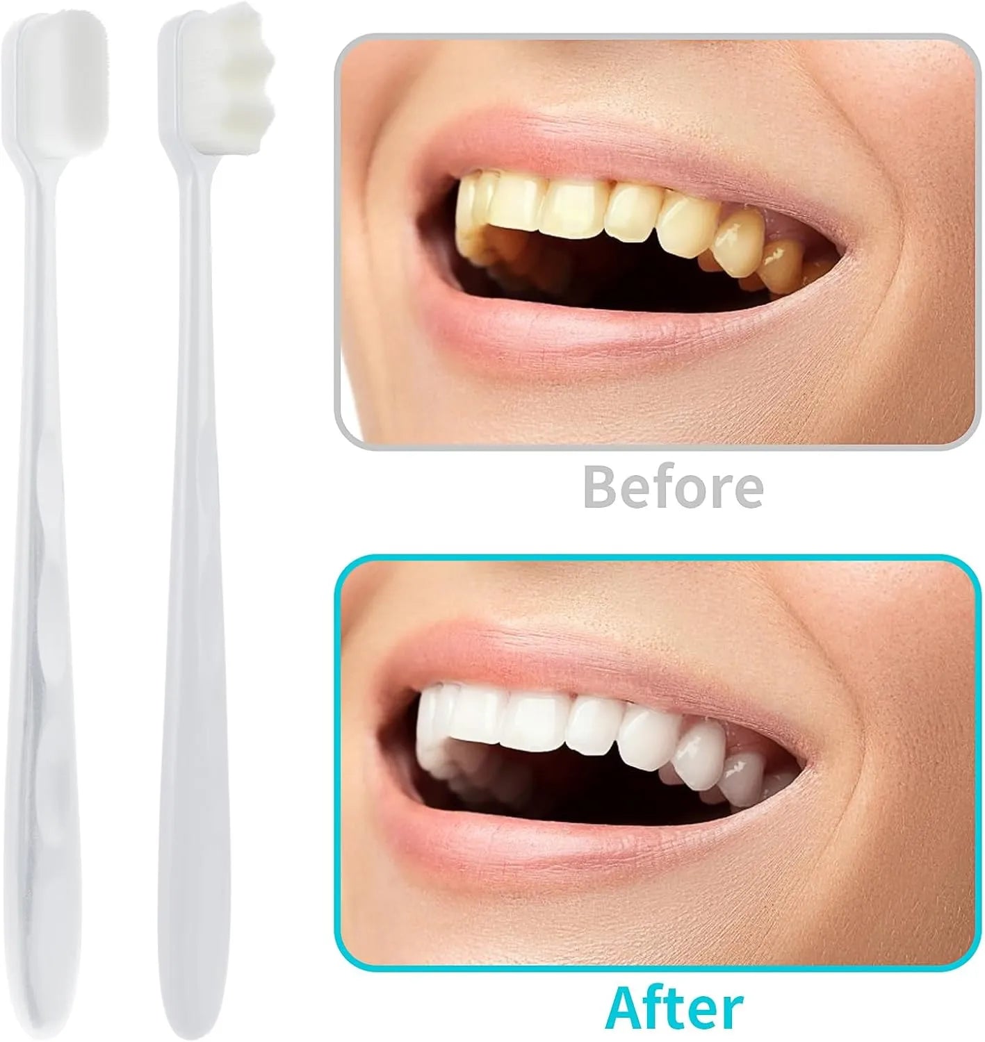 Ultra-soft toothbrush for sensitive gums providing a gentle and thorough cleaning experience.