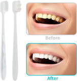 Ultra-soft toothbrush for sensitive gums providing a gentle and thorough cleaning experience.