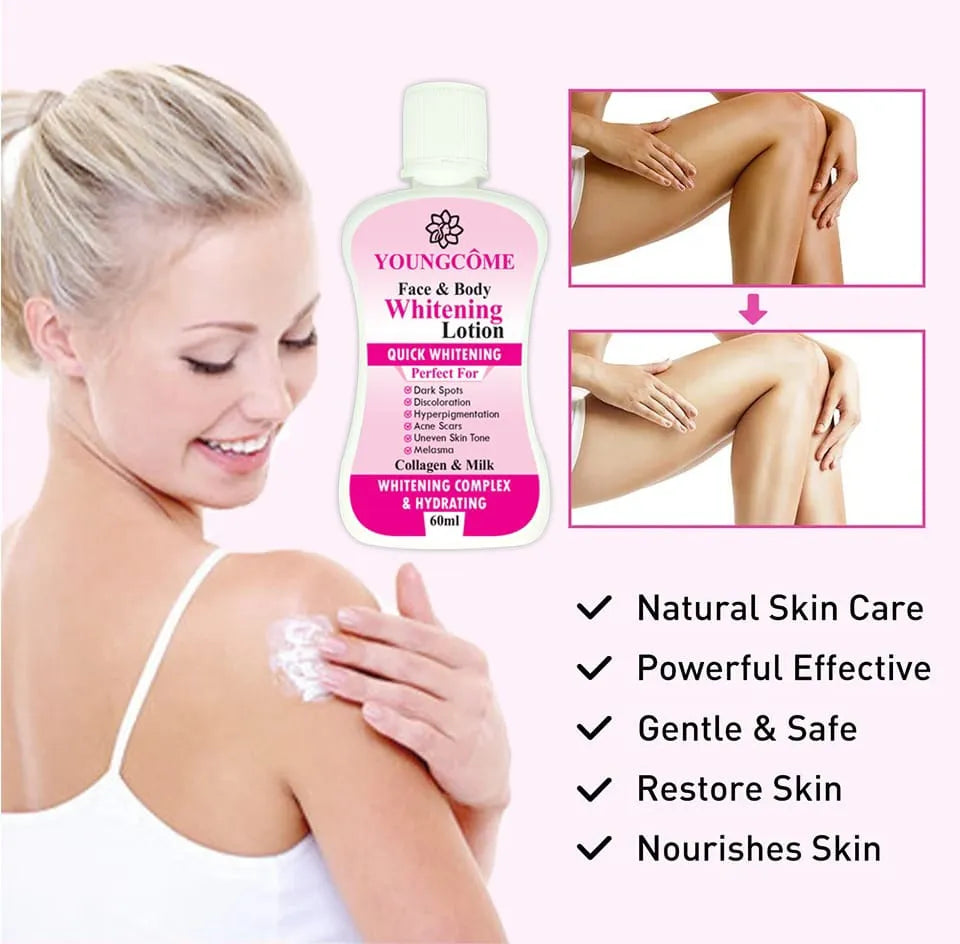 Woman applying lotion to shoulder with Youngcome product and before-and-after images of legs.
