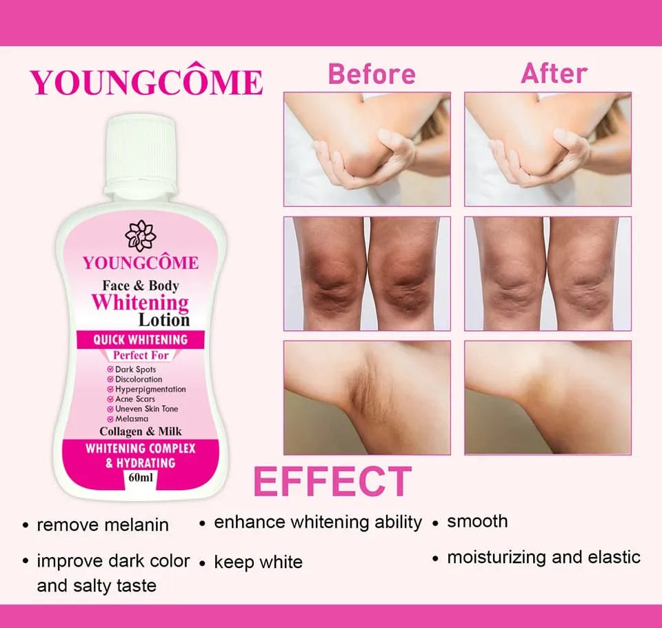 Youngcome face and body whitening lotion with 'before' and 'after' skin comparison on a pink background.